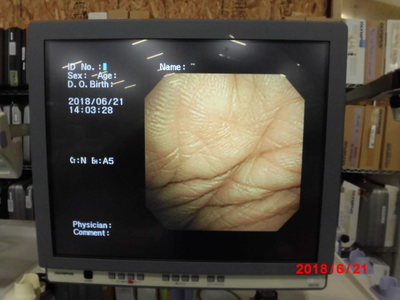 Bronchial videoscope 5