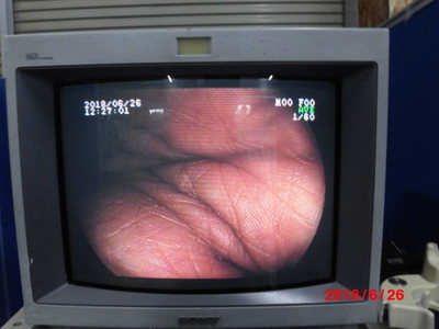 Upper gastrointestinal videoscope 5