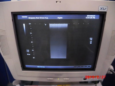 The ultrasonic diagnostic apparatus 5