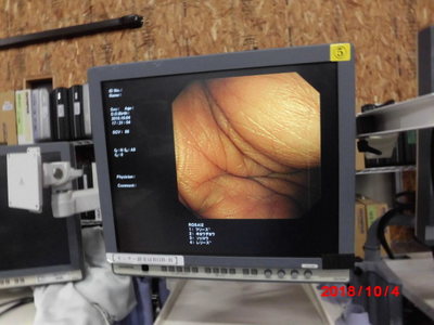 Colon videoscope 5