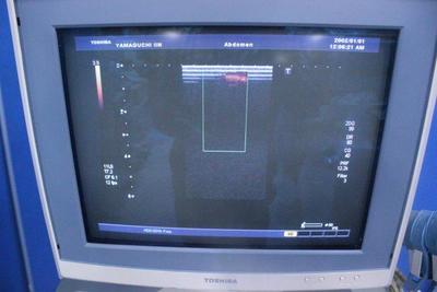 The Ultrasonic diagnostic apparatus Ultrasound 5
