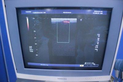 The ultrasonic diagnostic apparatus 5