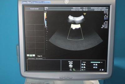 The ultrasonic diagnostic apparatus 5