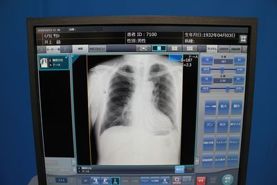 Computed Radiograph 5