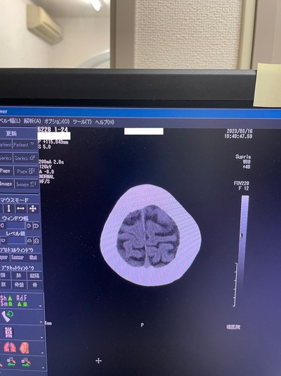 Multi-Slice CT Installation 5