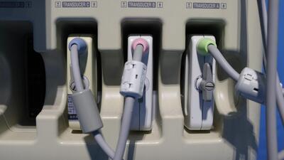 The ultrasonic diagnostic apparatus 5
