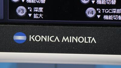 超音波診断装置の写真5枚目