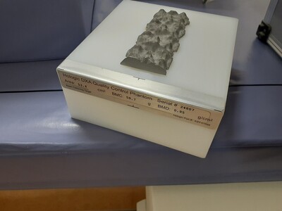 X-Ray Bone Demsitometer 5