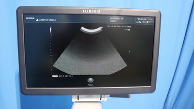 超音波診断装置の写真5枚目