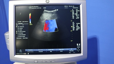 The ultrasonic diagnostic apparatus 5
