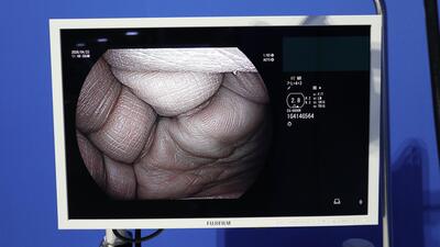 Endoscope Light Source & Processor 5