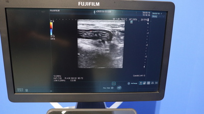 Ultrasound Diagnostic System 5