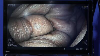 Endoscope Light Source & Processor 5