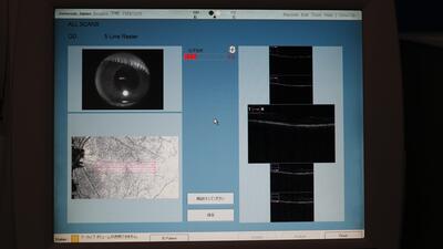 Optical Coherence Tomography 5