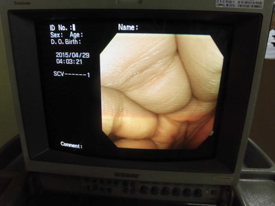 Colon videoscope 6