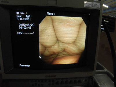Colon videoscope 6