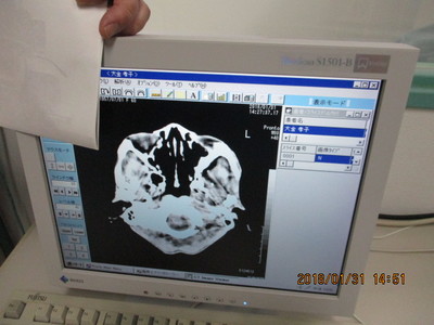 CT apparatus 6