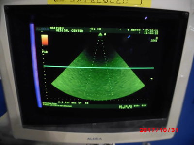 The ultrasonic diagnostic apparatus 6