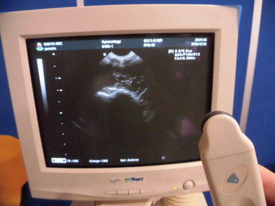 Ultrasound 6