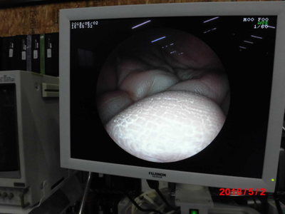 Video scope for nasal 6