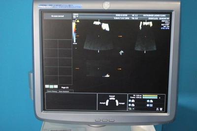 The ultrasonic diagnostic apparatus 6