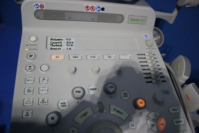 超音波診断装置の写真6枚目