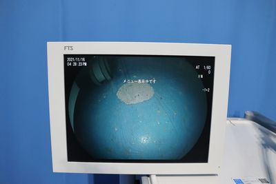 Laser Endoscopy System 6