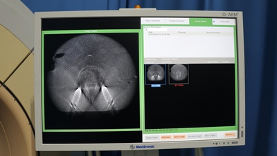 O-Arm Operation Imaging System 6