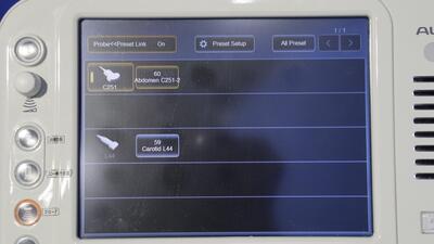 超音波診断装置の写真6枚目