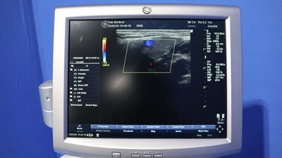 The ultrasonic diagnostic apparatus 6