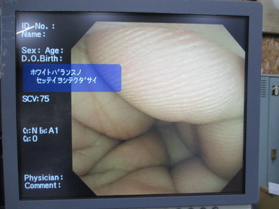 Colon videoscope 7