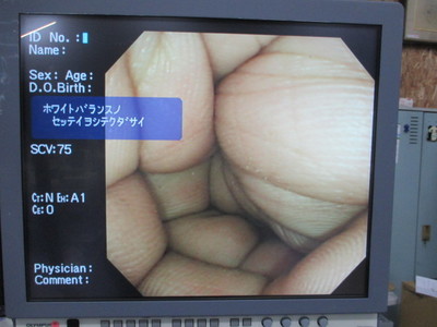 Colon videoscope 7