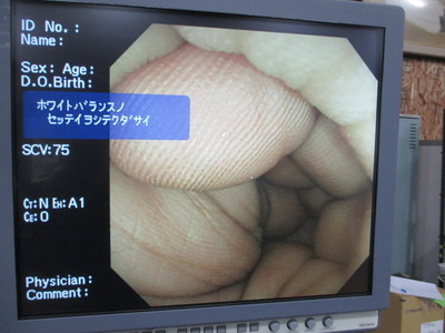 Colon videoscope 7