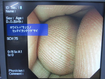 Colon videoscope 7