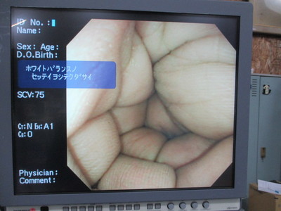 Colon videoscope 7