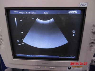 The ultrasonic diagnostic apparatus 7