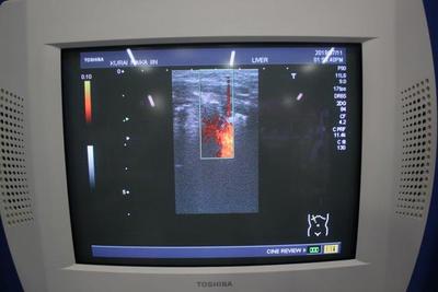 Ultrasound 7