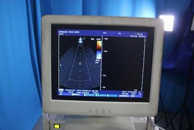 The ultrasonic diagnostic apparatus 7