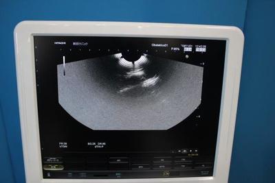 The ultrasonic diagnostic apparatus 7