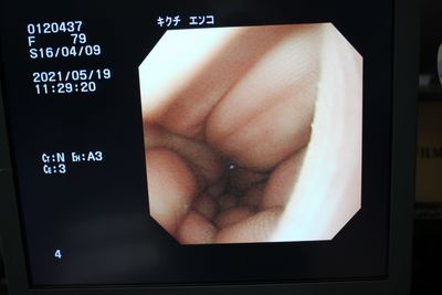 Upper gastrointestinal videoscope 7