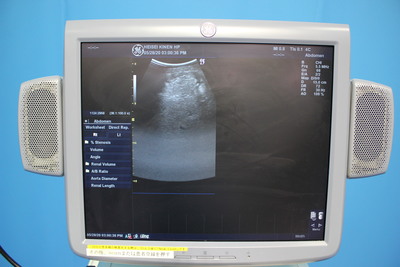 The ultrasonic diagnostic apparatus 7