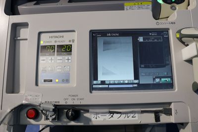 Portable X-Ray 7
