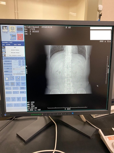 Multi-slice CT apparatus 7