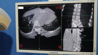 O-Arm Operation Imaging System 7