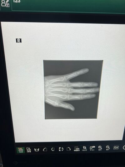 Digital Radiograph System 7