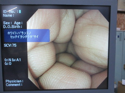 Colon videoscope 8