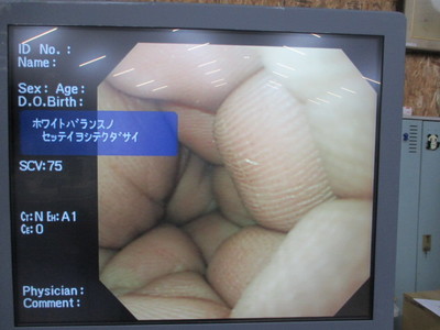 Upper gastrointestinal videoscope 8