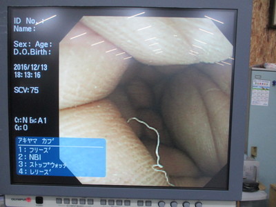 Colon videoscope 8