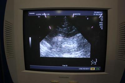 Ultrasound 8
