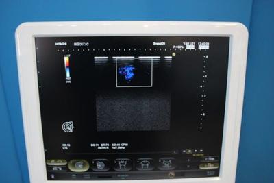 The ultrasonic diagnostic apparatus 8